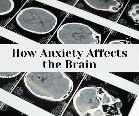 Anxiety Effects on Brain