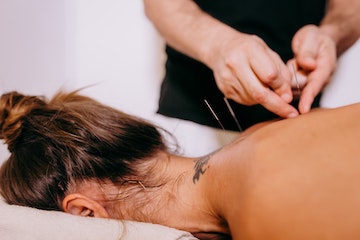 Acupuncture Holistic Practices